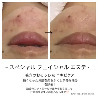 ビューティー ミロワールのエステ・リラクイメージ