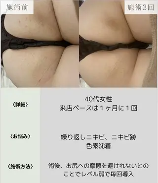 脱毛・眉毛・フェイス サロンN久留米店の眉毛・アイブロウイメージ