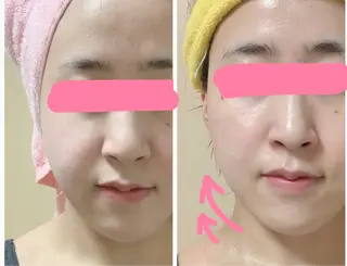 メナードフェイシャルサロン　松岡樋爪代行店所属・HIKARI ˖ ࣪⊹のエステ・リラクイメージ