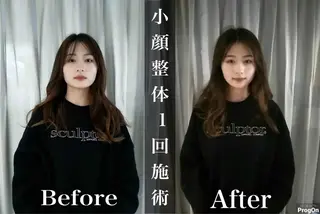 鍼灸 Refineのその他イメージ