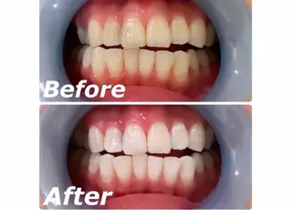 eclatie(エクラティエ)所属・横井 愛奈のエステ・リラクイメージ