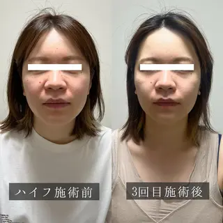 脱毛専門サロン BELFINE恵比寿のエステ・リラクイメージ