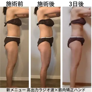 小顔.足痩せ整体 痩身天六Sunaoのその他イメージ