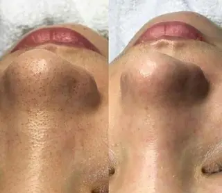 Lila プライベートサロンのエステ・リラクイメージ