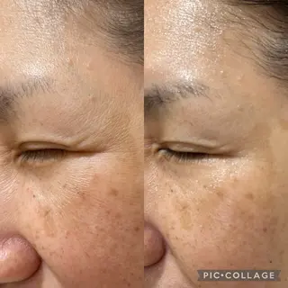 肌質改善 ×ネイルサロンのネイルデザイン