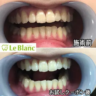 メンズ Le Blanc  奈良店のその他イメージ