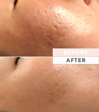 M.plus所属・水光韓国肌ハーブ ピーリングMplusのエステ・リラクイメージ