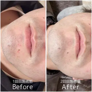 脱毛・ホワイトニング 耳ツボ・美白・毛穴のその他イメージ