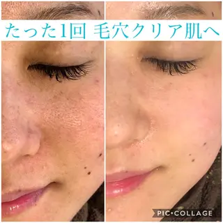 セミロング カラー パーマ ヘアアレンジ キッズ ネイル マツエク・マツパ EnsorClair 代表 野口真央のエステ・リラクイメージ