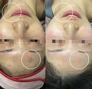 看護師が施術する美容 ナスサロ/川口のエステ・リラクイメージ