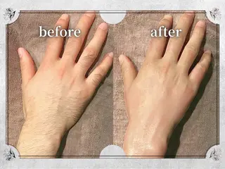 都度払い 脱毛 Lino柏/moeのエステ・リラクイメージ