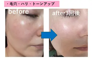 光フェイシャル・脱毛 MIA.ROSAのエステ・リラクイメージ