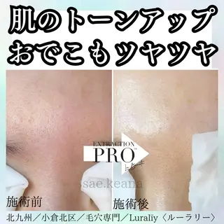 Luralïy hair kitakyushu所属・Luralïy ルーラリーのエステ・リラクイメージ