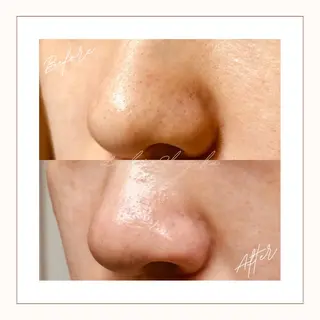 美腸サロン🌺 腸もみ/小顔/リンパのエステ・リラクイメージ