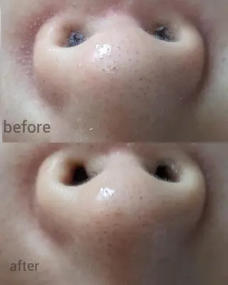 南流山 ネイルサロン グランツィア のネイルデザイン