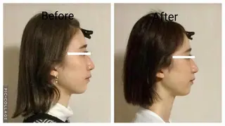 小顔矯正Sho  FaceDesignのエステ・リラクイメージ