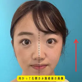 Nexfit for Beauty小顔矯正のエステ・リラクイメージ