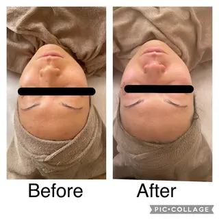 ECXIA ｴｸｼｱのエステ・リラクイメージ