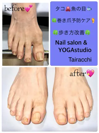 ネイル Tairacchi タイラッチのネイルデザイン
