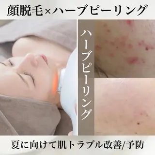 肌質改善×癒しサロン Bell skinのエステ・リラクイメージ
