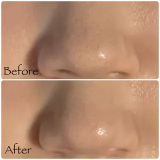 ソワン所属・脱毛 フェイシャル soin~ソワン~のエステ・リラクイメージ