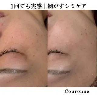 シミ・毛穴ケア専門 クロヌYUKIのエステ・リラクイメージ