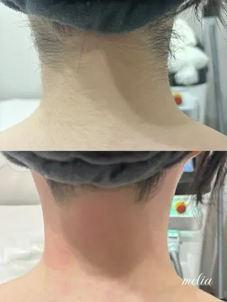 melia 岡山駅前店のエステ・リラクイメージ