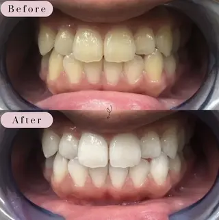 ホワイトニングサロン rize　花岡のその他イメージ