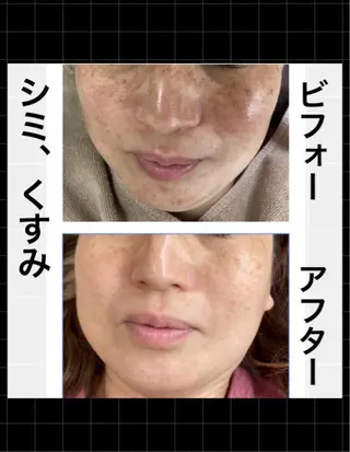 ハーブピーリング専門 MOKAのエステ・リラクイメージ