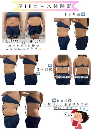 脂肪冷却/美肌改善 COCOKARAのエステ・リラクイメージ