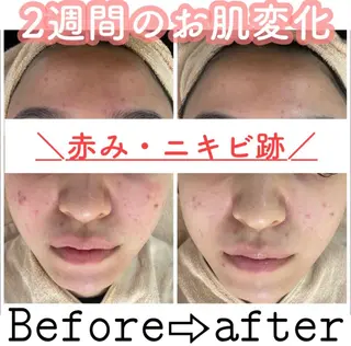 都度払い肌改善専門店 店長二上文香のエステ・リラクイメージ