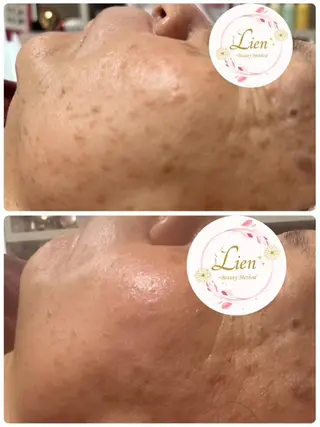 Lien オーナー　山口智嘉のエステ・リラクイメージ