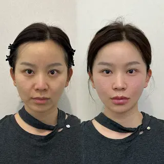 マツエク・マツパ 愛維美水光美肌専門店 メンズレディースokのエステ・リラクイメージ