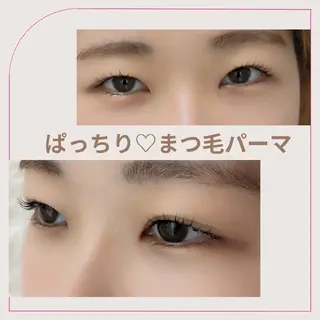 マツエク・マツパ 結果が出るスキンケア 肌質改善/まつパのエステ・リラクイメージ