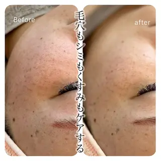 im所属・nagasawa asukaのネイルデザイン