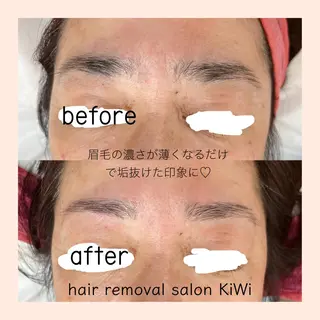 アイブロウ 脱毛サロン KiWiのエステ・リラクイメージ