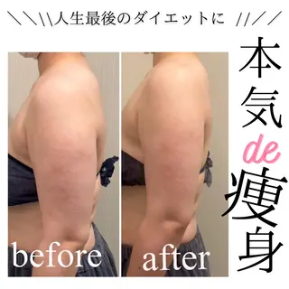 小顔・リフトアップ/ 奈緒美のエステ・リラクイメージ