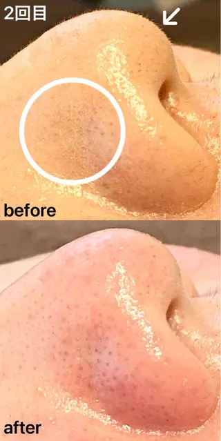 眉毛×小顔矯正サロン パピヨンsakiのエステ・リラクイメージ