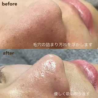 New __のその他イメージ