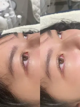マツエク・マツパ 高濱 ひなよのヘアスタイル