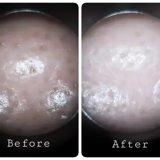 メナードフェイシャルサロンブランシェラテ所属・村井 沙也香のエステ・リラクイメージ