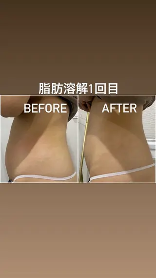 毛穴洗浄・痩身・脱毛 /アルカンジュのエステ・リラクイメージ