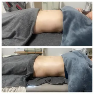 セルライトクラッシュ ＆腸もみ＋骨盤矯正のその他イメージ