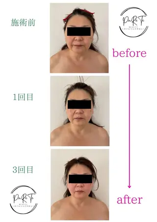 リンパ・小顔サロン PuReTeのエステ・リラクイメージ