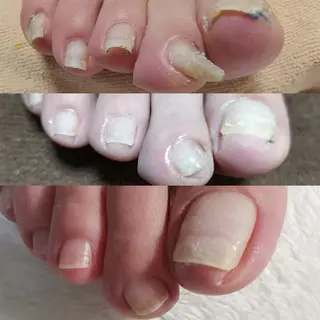 ネイル reve あやののネイルデザイン