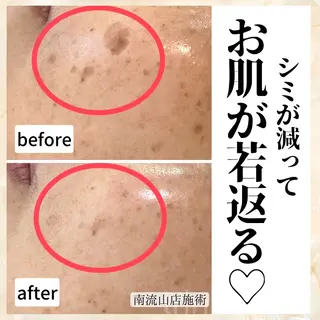 シミケア肌改善専門 トリニエンス新宿店のエステ・リラクイメージ