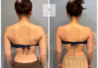 小顔/たるみ/黒ずみ除去専門サロン/SONA 大和西大寺店所属・【小顔痩身専門看護師 サロンSONA】のエステ・リラクイメージ