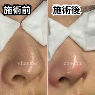 佐藤 明香のマツエク・マツパデザイン