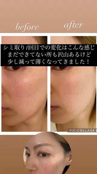 marrina terraceのエステ・リラクイメージ