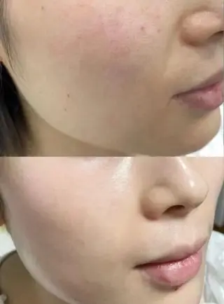 ネイル aliaハイフ&水光ジェットサロン所属・aliaハーブ水光店 エステティシャン募集のエステ・リラクイメージ